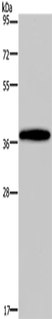 Rabbit Polyclonal Antibody to DLX4