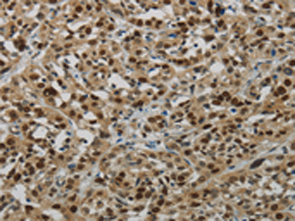 Rabbit Polyclonal Antibody to LIG1