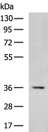 Rabbit Polyclonal Antibody to DNASE1L3