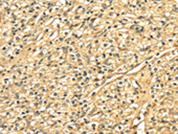 Rabbit Polyclonal Antibody to DNASE1