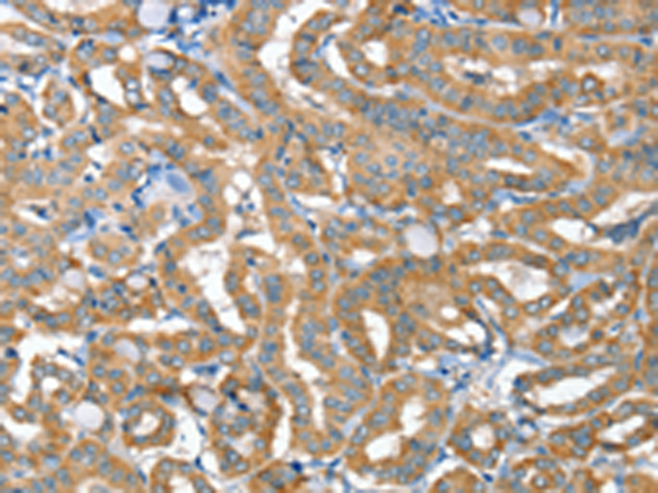 Rabbit Polyclonal Antibody to TNFRSF21