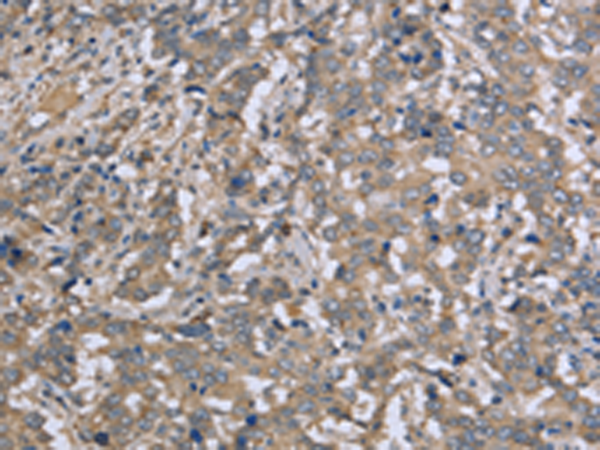 Rabbit Polyclonal Antibody to DTNB