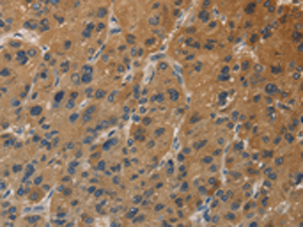 Rabbit Polyclonal Antibody to DUSP23
