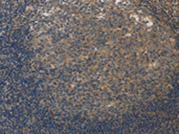 Rabbit Polyclonal Antibody to DUSP26