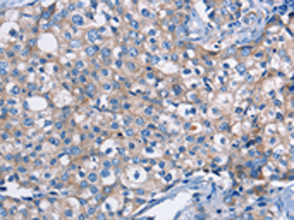 Rabbit Polyclonal Antibody to DMD