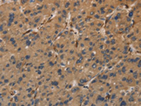 Rabbit Polyclonal Antibody to UBE2S