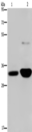 Rabbit Polyclonal Antibody to MAPRE3