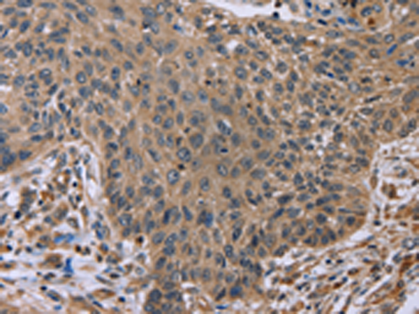 Rabbit Polyclonal Antibody to EDA