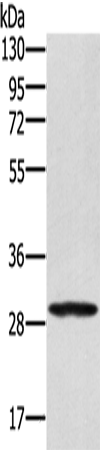 Rabbit Polyclonal Antibody to EDA2R