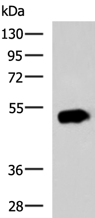 Rabbit Polyclonal Antibody to EDIL3