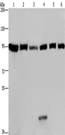 Rabbit Polyclonal Antibody to EEF2