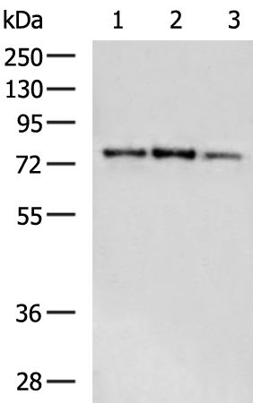 Rabbit Polyclonal Antibody to EEF2K