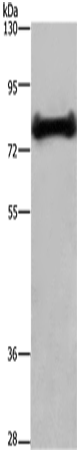 Rabbit Polyclonal Antibody to EHHADH