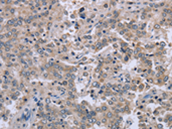 Rabbit Polyclonal Antibody to EID1
