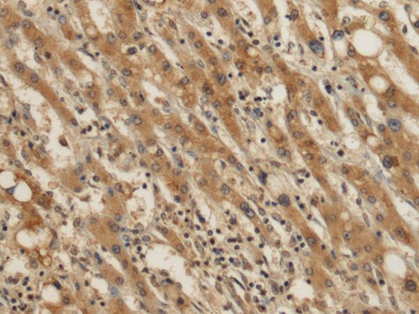 Rabbit Polyclonal Antibody to EIF4B