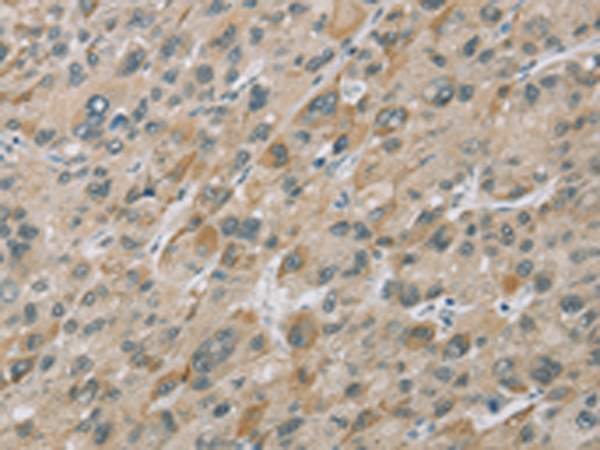 Rabbit Polyclonal Antibody to EIF5