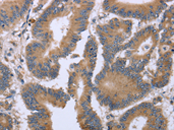 Rabbit Polyclonal Antibody to KIAA1324