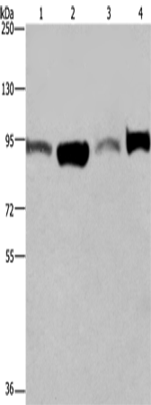 Rabbit Polyclonal Antibody to ELAC2