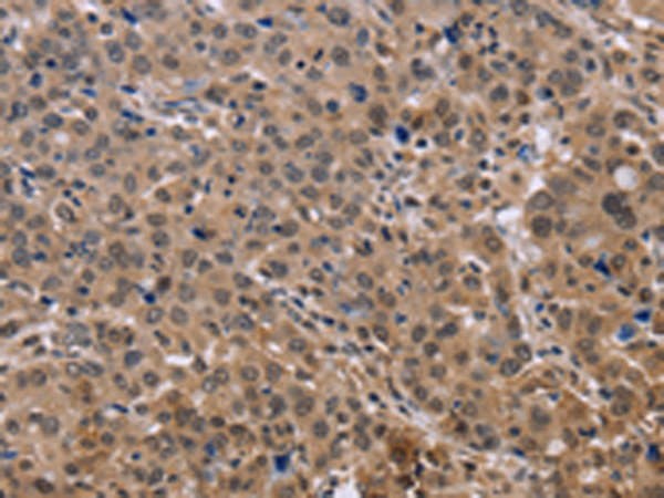 Rabbit Polyclonal Antibody to KIF25