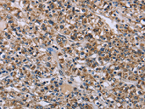 Rabbit Polyclonal Antibody to KCNJ11