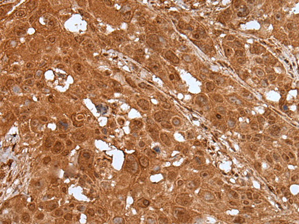 Rabbit Polyclonal Antibody to ELF1