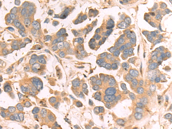Rabbit Polyclonal Antibody to ELMO1