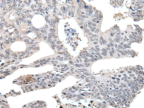 Rabbit Polyclonal Antibody to ELOB