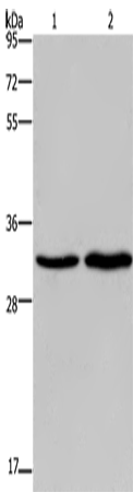 Rabbit Polyclonal Antibody to ELOVL1