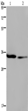 Rabbit Polyclonal Antibody to EMD
