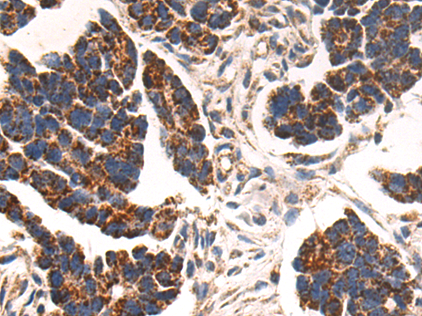 Rabbit Polyclonal Antibody to SCNN1G
