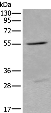 Rabbit Polyclonal Antibody to LIPG