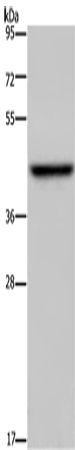 Rabbit Polyclonal Antibody to ENTPD5