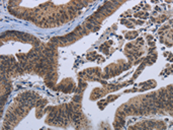 Rabbit Polyclonal Antibody to EPHA10