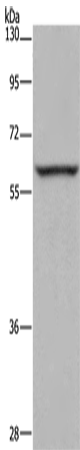 Rabbit Polyclonal Antibody to ESR2