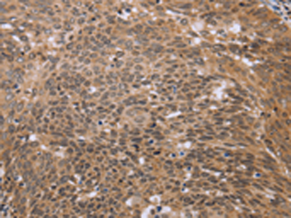 Rabbit Polyclonal Antibody to ERCC6L