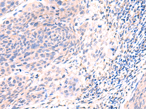 Rabbit Polyclonal Antibody to ESM1