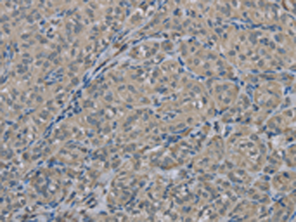 Rabbit Polyclonal Antibody to EDN1