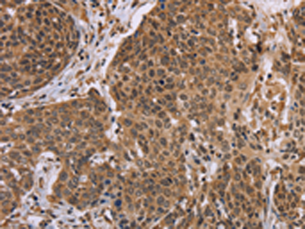 Rabbit Polyclonal Antibody to EDN2