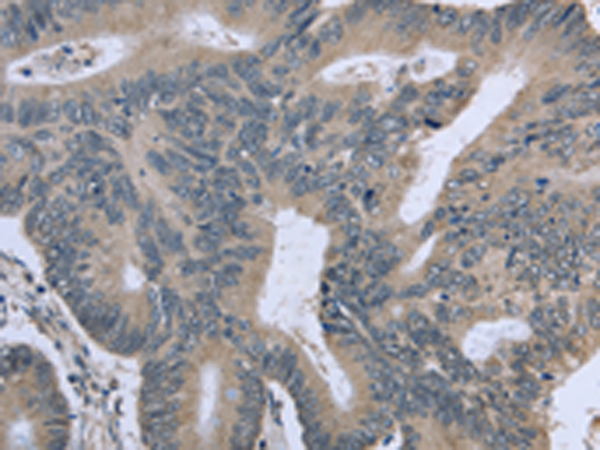 Rabbit Polyclonal Antibody to BMX