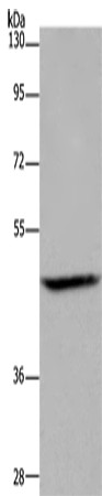 Rabbit Polyclonal Antibody to ETS2