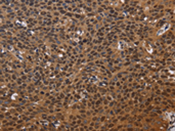 Rabbit Polyclonal Antibody to EXTL3