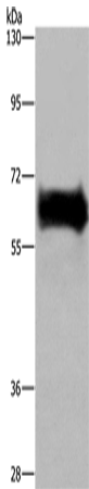 Rabbit Polyclonal Antibody to EZR