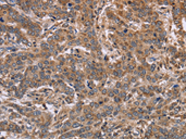 Rabbit Polyclonal Antibody to FAAH2