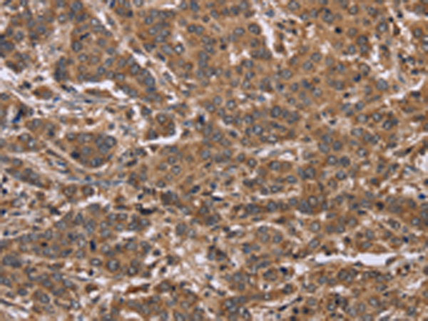 Rabbit Polyclonal Antibody to FABP6