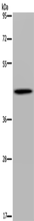 Rabbit Polyclonal Antibody to FADS1