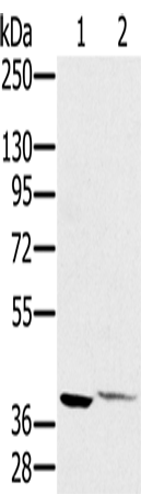Rabbit Polyclonal Antibody to FCMR