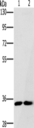 Rabbit Polyclonal Antibody to FAIM2