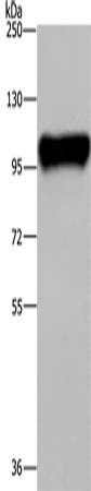 Rabbit Polyclonal Antibody to PTK2B