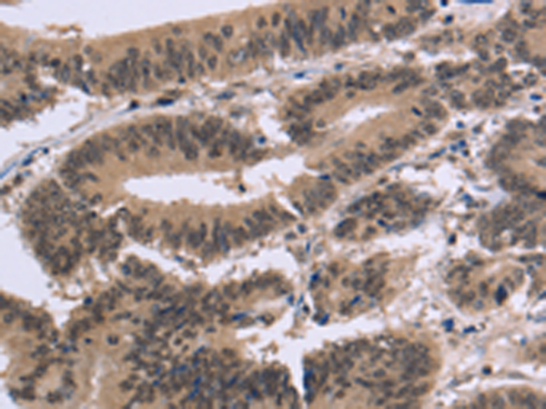Rabbit Polyclonal Antibody to FAM107A