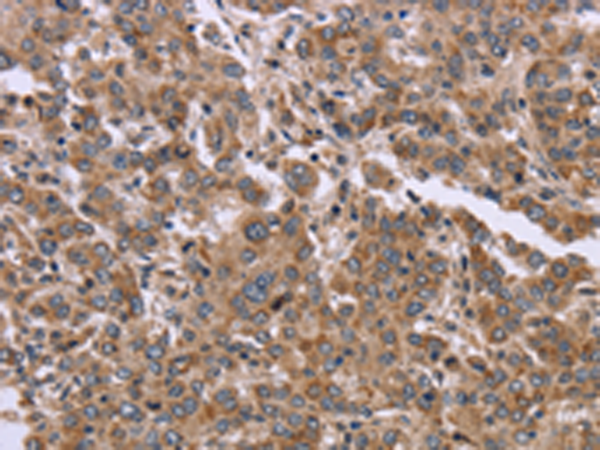 Rabbit Polyclonal Antibody to FAM3B